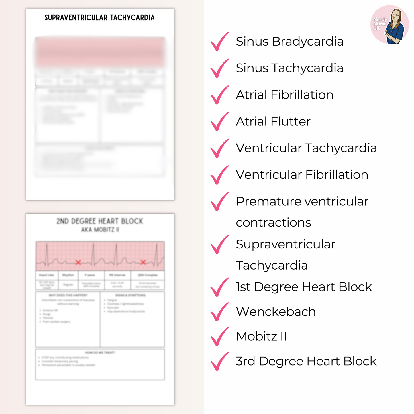 ECG Interpretation digital download